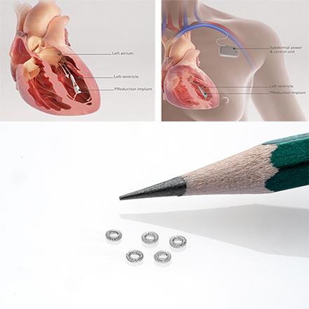 Flexible Electrode Leads